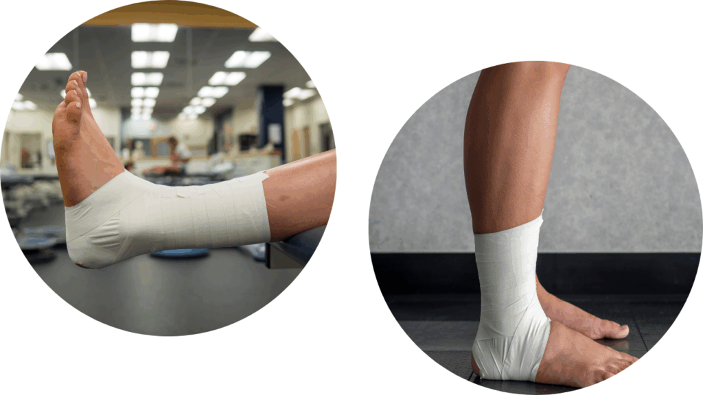 足首(足関節)のテーピング