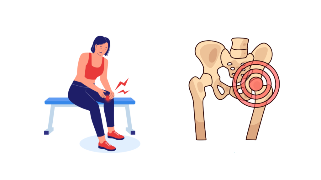 膝の痛みに悩む女性 骨盤のゆがみによる股関節の痛みのイラスト