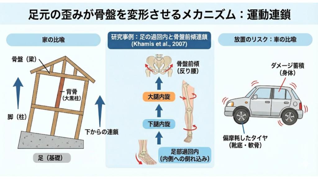 足元のゆがみが骨盤を変形させるメカニズム：運動連鎖を説明したイラスト
