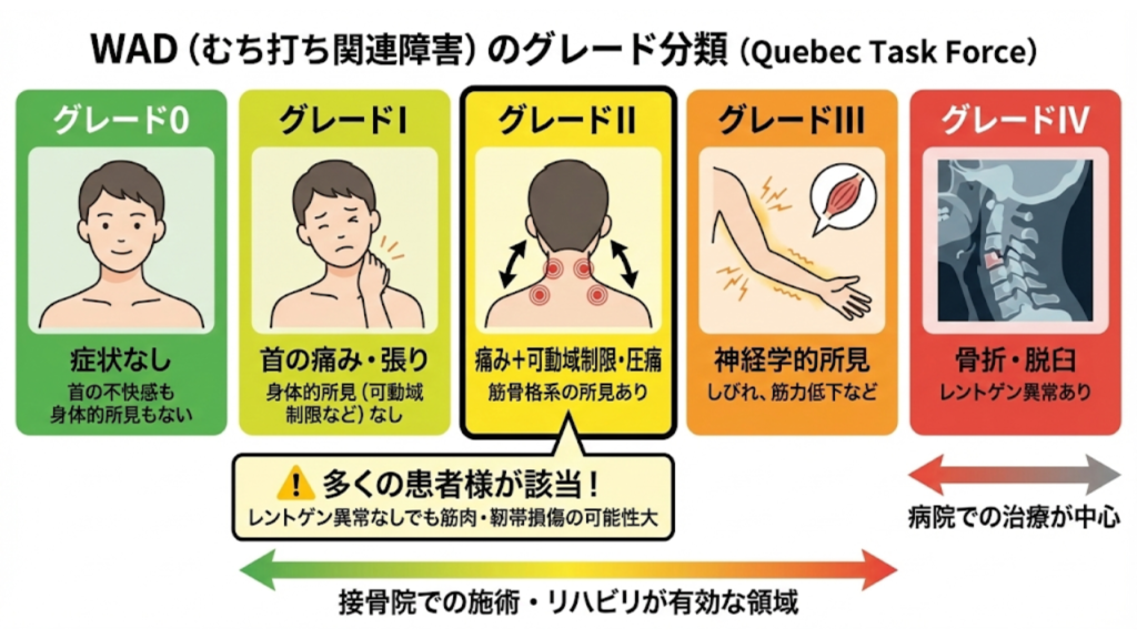 むち打ち関連障害のグレード分類を解説したイラスト