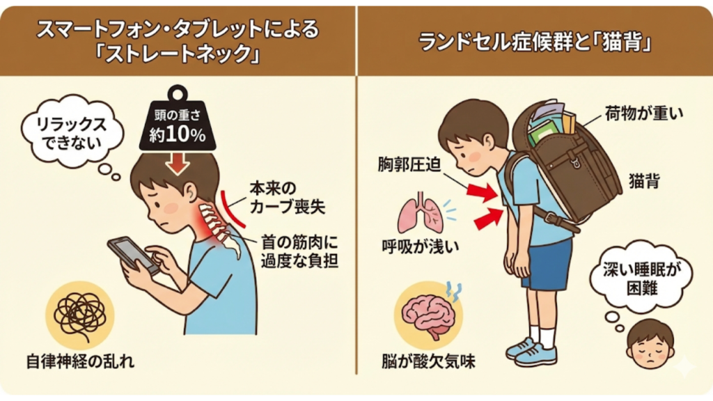 子供たちを襲う現代病と姿勢の関係を解説したイラスト